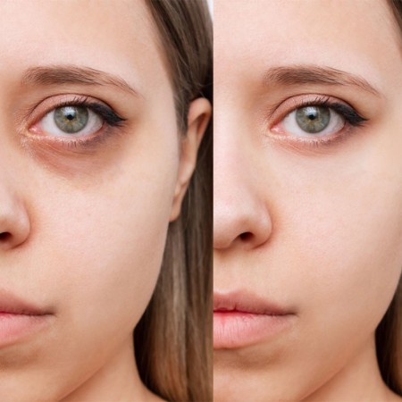 Llorca Stick Concealer 1 -Gesicht -Elisabeth Llorca 2